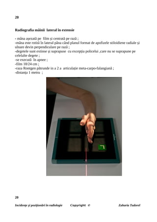 20
Radiografia mâinii lateral în extensie
- mâna așezată pe film și centrată pe rază ;
-mâna este rotită în lateral pâna când planul format de apofizele stiloidiene radiale și
ulnare devin perpendiculare pe rază ;
-degetele sunt extinse și suprapuse cu excepția policelui ,care nu se suprapune pe
celelalte degete ;
-se execută în apnee ;
-film 18/24 cm ;
-raza Rontgen pătrunde in a 2 a articulație meta-carpo-falangiană ;
-distanța 1 metru ;
20
Incidențe și poziționări în radiologie Copyright © Zaharia Tudorel
 