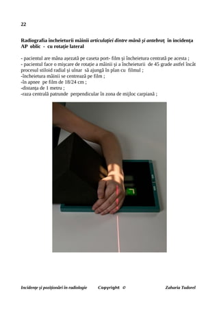 22
Radiografia încheieturii mâinii articulației dintre mână și antebraț în incidența
AP oblic - cu rotație lateral
- pacientul are mâna așezată pe caseta port- film și încheietura centrată pe acesta ;
- pacientul face o mișcare de rotație a mâinii și a încheieturii de 45 grade astfel încât
procesul stiloid radial și ulnar să ajungă în plan cu filmul ;
-încheietura mâinii se centrează pe film ;
-în apnee pe film de 18/24 cm ;
-distanța de 1 metru ;
-raza centrală patrunde perpendicular în zona de mijloc carpiană ;
Incidențe și poziționări în radiologie Copyright © Zaharia Tudorel
 