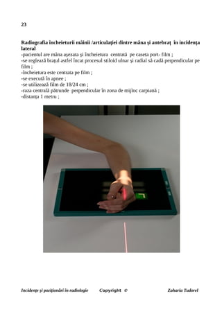 23
Radiografia încheieturii mâinii /articulației dintre mâna și antebraț în incidența
lateral
-pacientul are mâna așezata și încheietura centrată pe caseta port- film ;
-se reglează brațul astfel încat procesul stiloid ulnar și radial să cadă perpendicular pe
film ;
-încheietura este centrata pe film ;
-se execută în apnee ;
-se utilizează film de 18/24 cm ;
-raza centrală pătrunde perpendicular în zona de mijloc carpiană ;
-distanța 1 metru ;
Incidențe și poziționări în radiologie Copyright © Zaharia Tudorel
 