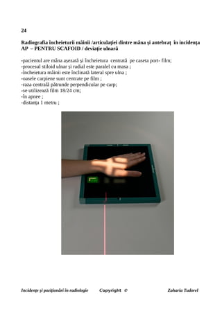 24
Radiografia încheieturii mâinii /articulației dintre mâna și antebraț în incidența
AP – PENTRU SCAFOID / deviație ulnară
-pacientul are mâna așezată și încheietura centrată pe caseta port- film;
-procesul stiloid ulnar și radial este paralel cu masa ;
-încheietura mâinii este înclinată lateral spre ulna ;
-oasele carpiene sunt centrate pe film ;
-raza centrală pătrunde perpendicular pe carp;
-se utilizează film 18/24 cm;
-în apnee ;
-distanța 1 metru ;
Incidențe și poziționări în radiologie Copyright © Zaharia Tudorel
 