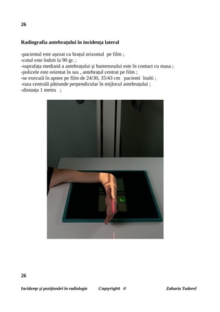 26
Radiografia antebrațului în incidența lateral
-pacientul este așezat cu brațul orizontal pe film ;
-cotul este îndoit la 90 gr. ;
-suprafața mediană a antebrațului și humerusului este în contact cu masa ;
-policele este orientat în sus , antebrațul centrat pe film ;
-se execută în apnee pe film de 24/30, 35/43 cm pacienti înalti ;
-raza centrală pătrunde perpendicular în mijlocul antebrațului ;
-distanța 1 metru ;
26
Incidențe și poziționări în radiologie Copyright © Zaharia Tudorel
 