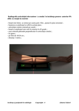 Radiografia articulației olecraniene / a cotului în incidența postero -anterior PA
oblic cu rotație în exterior
- brațul este întins și centrat pe caseta port- film , ajustat în plan orizontal ;
- humerus și antebrațul se află în același plan ;
- articulația cotului centrată pe casetă ;
- brațul și antebrațul este rotit în exterior la 45 grade ;
- raza centrală pătrunde perpendicular în articulația cotului ;
- în apnee ;
- pe film de 18/24 cm ;
- distanța 1 metru ;
Incidențe și poziționări în radiologie Copyright © Zaharia Tudorel
 