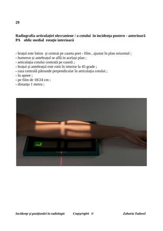 29
Radiografia articulației olecraniene / a cotului în incidența postero - anterioară
PA oblic medial rotație interioară
- brațul este întins și centrat pe caseta port - film , ajustat în plan orizontal ;
- humerus și antebrațul se află in același plan ;
- articulația cotului centrată pe casetă ;
- brațul și antebrațul este rotit în interior la 45 grade ;
- raza centrală pătrunde perpendicular în articulația cotului ;
- în apnee ;
- pe film de 18/24 cm ;
- distanța 1 metru ;
Incidențe și poziționări în radiologie Copyright © Zaharia Tudorel
 