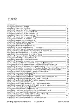 CUPRINS
Nota autorului.......................................................................................................................................................... 6
Radiografia pulmonar de f
a ..................................................................................................................... 7
ă ță
Radiografia pulmonar de profil ................................................................................................................. 8
ă
Radiografia pulmonar (PA ) -Lordoza................................................................................................. 9
ă
Radiografia pulmonar cu pacientul în DD ........................................................................................... 10
ă
Radiografia pulmonar în decubit lateral AP ...................................................................................... 11
ă
Radiografia pulmonar in decubit lateral PA........................................................................................ 12
ă
Radiografia pulmonar în inciden OPS............................................................................................... 13
ă ță
Radiografia pulmonar în inciden OPD ............................................................................................... 14
ă ță
Radiografia abdominal în inciden a DD ................................................................................................ 15
ă ț
Radiografia abdominal în ortostatism P A ......................................................................................... 16
ă
Radiografia mâinii în inciden a PA ............................................................................................................. 17
ț
Radiografia mâinii în inciden a oblic PA
ț .................................................................................................. 18
Radiografia mâinii în inciden a lateral ‘’Ventilator ‘’........................................................................ 19
ț
Radiografia mâinii lateral în extensie ....................................................................................................... 20
Radiografia articula iei dintre mâna si antebra în inciden a AP............................................... 21
ț ț ț
Radiografia încheieturii mâinii - cu rota ie lateral ............................................................................ 22
ț
Radiografia încheieturii mâinii în inciden a lateral ........................................................................... 23
ț
Radiografia încheieturii mâinii PENTRU SCAFOID ............................................................................ 24
Radiografia antebra ului în inciden a P A................................................................................................ 25
ț ț
Radiografia antebra ului în inciden a lateral ......................................................................................... 26
ț ț
Radiografia articula iei olecraniene PA .................................................................................................. 27
ț
Radiografia articula iei olecraniene PA oblic cu rota ie în exterior.......................................... 28
ț ț
Radiografia articula iei olecraniene PA oblic medial rota ie interioar ............................. 29
ț ț ă
Radiografia articula iei olecraniene în inciden a lateral ................................................................ 30
ț ț
Radiografia articula iei olecraniene cu flexie par ial pentru antebra ul proximal ...... 31
ț ț ă ț
Radiografia articula iei olecraniene cu flexie par ial pentru humerus distal ................ 32
ț ț ă
Radiografia humerus în inciden a postero – anterioar PA......................................................... 33
ț ă
Radiografia humerus în inciden a lateral ................................................................................................ 34
ț
Radiografia um rului în inciden a PA ....................................................................................................... 35
ă ț
Radiografia um rului în inciden a PA - În pozi ie neutr pentru trauma ........................... 36
ă ț ț ă
Radiografia um rului în inciden a PA cu rota ie interioar ........................................................ 37
ă ț ț ă
Radiografia um rului în inciden a P A rota ie scapular ............................................................... 38
ă ț ț ă
Radiografia scapulei în inciden a AP ....................................................................................................... 39
ț
Radiografia scapular în inciden a OAD / oblic anterior drept................................................. 40
ă ț
Radiografia scapular în inciden a OPD- (oblic posterior drept )............................................ 41
ă ț
Radiografia claviculei în inciden a AP/ PA.............................................................................................. 41
ț
Radiografia claviculei în inciden a axial PA ...................................................................................... 42
ț ă
Radiografia claviculelor articulatia acro-micro-claviculara (CA) PA ........................................... 43
Radiografia piciorului în inciden a standard ...................................................................................... 44
ț
Radiografia piciorului AP medial- oblic cu rota ie interioar ........................................................ 45
ț ă
Radiografia piciorului în inciden a medio-lateral .............................................................................. 46
ț
Radiografia gleznei în inciden a AP / standard /de f
ata ............................................................ 47
ț
Incidențe și poziționări în radiologie Copyright © Zaharia Tudorel
 