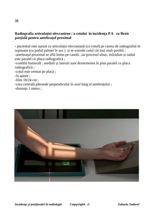 31
Radiografia articulației olecraniene / a cotului în incidența PA cu flexie
parțială pentru antebrațul proximal
- pacientul este așezat cu articulația olecraniană (cu cotul) pe caseta de radiografiat în
supinație (cu podul palmei în sus ) și se extinde cotul cât mai mult posibil ;
-antebrațul proximal se află întins pe casetă , iar procesul ulnar, stiloidian și radial
este paralel cu placa radiografică ;
-condilii humerali , mediali și laterali sunt deasemenea în plan paralel cu placa
radiografică ;
-cotul este centrat pe placă ;
-în apnee ;
-film 18/24 cm ;
-raza centrală pătrunde perpendicular în axul lung al antebrațului ;
-distanța 1 metru ;
Incidențe și poziționări în radiologie Copyright © Zaharia Tudorel
 