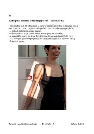 33
Radiografia humerus în incidența postero – anterioară PA
-pacientul se află în ortostatism la stativul aparatului cu fața la tubul de raze ;
- cu brațul în contact cu placa radiografică , centrat cu humerus pe placă ;
-se extinde cotul și se rotește mâna ;
-se îndepartează puțin brațul pentru a nu suprapune toracele ;
-se execută în apnee pe filme de 24/30 cm , la pacienti înalți 35/43 cm ;
-raza Rontgen pătrunde perpendicular în arborele central al humerus-ului ;
-distanța 1 metru ;
Incidențe și poziționări în radiologie Copyright © Zaharia Tudorel
 