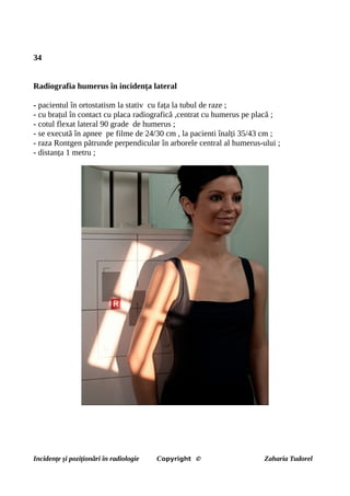 34
Radiografia humerus în incidența lateral
- pacientul în ortostatism la stativ cu fața la tubul de raze ;
- cu brațul în contact cu placa radiografică ,centrat cu humerus pe placă ;
- cotul flexat lateral 90 grade de humerus ;
- se execută în apnee pe filme de 24/30 cm , la pacienti înalți 35/43 cm ;
- raza Rontgen pătrunde perpendicular în arborele central al humerus-ului ;
- distanța 1 metru ;
Incidențe și poziționări în radiologie Copyright © Zaharia Tudorel
 