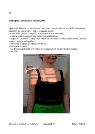 35
Radiografia umărului în incidența PA
- pacientul la stativ , în ortostatism , cu partea posterioară toracală (având un contact
uniform) pe caseta port – film , centrat cu Bucky;
-planul PMS ( medio – sagital ) este perpendicular pe casetă ;
-brațul în poziție anatomică cu palma orientată anterior ;
-se ajustează humerus- ul la planul format de epicondilii mediali astfel încât sa devină
paralel cu placa radiografică ;
-se execută în apnee pe film de 24/30 cm ;
-distanța de 1 metru ;
-raza Rontgen pătrunde perpendicular al aprox. 6.30 cm inferior procesului
coracoid ;
Incidențe și poziționări în radiologie Copyright © Zaharia Tudorel
 