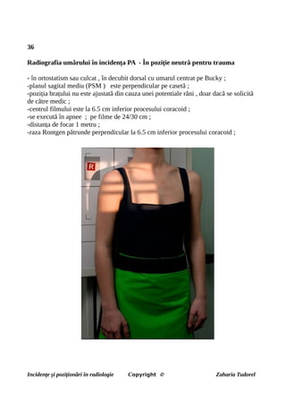 36
Radiografia umărului în incidența PA - În poziție neutră pentru trauma
- în ortostatism sau culcat , în decubit dorsal cu umarul centrat pe Bucky ;
-planul sagital mediu (PSM ) este perpendicular pe casetă ;
-poziția brațului nu este ajustată din cauza unei potentiale răni , doar dacă se solicită
de către medic ;
-centrul filmului este la 6.5 cm inferior procesului coracoid ;
-se execută în apnee ; pe filme de 24/30 cm ;
-distanța de focar 1 metru ;
-raza Rontgen pătrunde perpendicular la 6.5 cm inferior procesului coracoid ;
Incidențe și poziționări în radiologie Copyright © Zaharia Tudorel
 