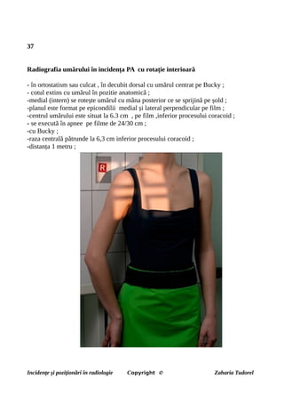 37
Radiografia umărului în incidența PA cu rotație interioară
- în ortostatism sau culcat , în decubit dorsal cu umărul centrat pe Bucky ;
- cotul extins cu umărul în pozitie anatomică ;
-medial (intern) se rotește umărul cu mâna posterior ce se sprijină pe șold ;
-planul este format pe epicondilii medial și lateral perpendicular pe film ;
-centrul umărului este situat la 6.3 cm , pe film ,inferior procesului coracoid ;
- se execută în apnee pe filme de 24/30 cm ;
-cu Bucky ;
-raza centrală pătrunde la 6,3 cm inferior procesului coracoid ;
-distanța 1 metru ;
Incidențe și poziționări în radiologie Copyright © Zaharia Tudorel
 