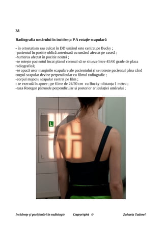 38
Radiografia umărului în incidența PA rotație scapulară
- în ortostatism sau culcat în DD umărul este centrat pe Bucky ;
-pacientul în pozitie oblică anterioară cu umărul afectat pe casetă ;
-humerus afectat în pozitie neutră ;
-se rotește pacientul încat planul coronal să se situeze între 45/60 grade de placa
radiografică;
-se apucă usor marginile scapulare ale pacientului și se rotește pacientul pâna când
corpul scapular devine perpendicular cu filmul radiografic ;
-corpul mijociu scapular centrat pe film ;
- se execută în apnee ; pe filme de 24/30 cm cu Bucky -distanța 1 metru ;
-raza Rontgen pătrunde perpendicular și posterior articulației umărului ;
Incidențe și poziționări în radiologie Copyright © Zaharia Tudorel
 
