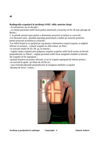 40
Radiografia scapulară în incidența OAD / oblic anterior drept
- în ortostatism sau în decubit ;
- se rotește pacientul astfel încat partea anterioară a toracelui să fie cât mai aproape de
Bucky ;
1. se prinde umarul opus pentru a demonstra procesul acromion și coracoid ;
2.se flexează cotul , plasând suprafața posterioară a mâinii pe toracele posterior
pentru procesul acromion și coracoid ;
3.se ridică brațul și se sprijină pe cap pentru a demonstra corpul scapular și unghiul
inferior al acestuia ; -centrul scapulei se află centrat pe film ;
-se execută rotatie de 45- 60 gr. în interior ;
- reglați rotația corpului prin palparea corpului scapular astfel încât acesta să devină
perpendicular cu filmul ; -reglați pacientul astfel încat marginile mediale și laterale
ale scapulei să fie suprapuse ;
-ajustați humerus pe partea afectată ,ci nu la scapula suprapusă de interes primar ;
-se execută în apnee pe filme de 24/30 cm ;
- raza centrală pătrunde perpendicular în marginea medială a scapulei
-distanța de focar 1 metru ;
Incidențe și poziționări în radiologie Copyright © Zaharia Tudorel
 