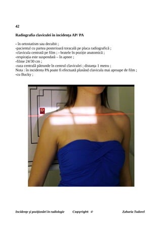 42
Radiografia claviculei în incidența AP/ PA
- în ortostatism sau decubit ;
-pacientul cu partea posterioară toracală pe placa radiografică ;
-clavicula centrată pe film ; - bratele în poziție anatomică ;
-respirația este suspendată – în apnee ;
-filme 24/30 cm ;
-raza centrală pătrunde în centrul claviculei ; distanța 1 metru ;
Nota : în incidenta PA poate fi efectuată plasând clavicula mai aproape de film ;
-cu Bucky ;
Incidențe și poziționări în radiologie Copyright © Zaharia Tudorel
 