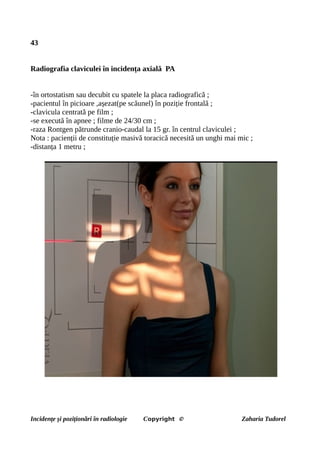 43
Radiografia claviculei în incidența axială PA
-în ortostatism sau decubit cu spatele la placa radiografică ;
-pacientul în picioare ,așezat(pe scăunel) în poziție frontală ;
-clavicula centrată pe film ;
-se execută în apnee ; filme de 24/30 cm ;
-raza Rontgen pătrunde cranio-caudal la 15 gr. în centrul claviculei ;
Nota : pacienții de constituție masivă toracică necesită un unghi mai mic ;
-distanța 1 metru ;
Incidențe și poziționări în radiologie Copyright © Zaharia Tudorel
 