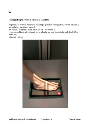 45
Radiografia piciorului în incidența standard
-suprafața plantară a piciorului așezată pe placa de radiografiat , centrat pe film ;
-articulația gleznei este extinsă ;
-se execută în apnee ; filme de 18/24 cm ; 24/30 cm ;
- raza centrală este directionată perpendicular pe axul lung și pătrunde în al 3 lea
metatars ;
-distanța 1 metru ;
Incidențe și poziționări în radiologie Copyright © Zaharia Tudorel
 