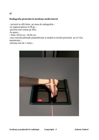 47
Radiografia piciorului în incidența medio-lateral
- piciorul se află întins pe masa de radiografiat ;
-se reglează glezna la 90 gr. ;
-piciorul este centrat pe film ;
-în apnee ;
- filme 18/24 cm ; 24/30 cm ;
-raza centrală pătrunde perpendicular și medial la nivelul piciorului pe al 3 lea
metatarsian ;
-distanța este de 1 metru ;
Incidențe și poziționări în radiologie Copyright © Zaharia Tudorel
 