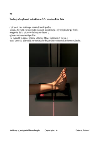 48
Radiografia gleznei în incidența AP / standard /de fata
- piciorul este extins pe masa de radiografiat ;
-glezna flectată cu suprafața plantară a piciorului perpendicular pe film ;
-degetele de la picioare îndreptate în sus ;
-glezna este centrată pe film ;
-se execută în apnee ; filme utilizate 18/24 ; distanța 1 metru ;
-raza centrală pătrunde perpendicular la jumătatea drumului dintre maleole ;
Incidențe și poziționări în radiologie Copyright © Zaharia Tudorel
 