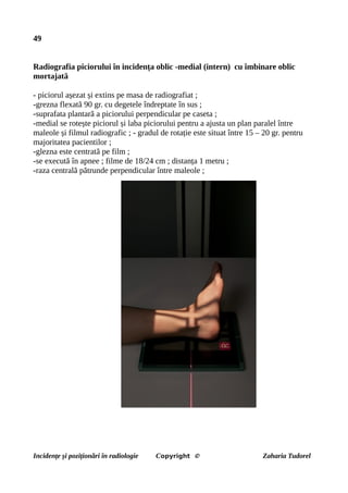 49
Radiografia piciorului în incidența oblic -medial (intern) cu îmbinare oblic
mortajată
- piciorul așezat și extins pe masa de radiografiat ;
-grezna flexată 90 gr. cu degetele îndreptate în sus ;
-suprafata plantară a piciorului perpendicular pe caseta ;
-medial se rotește piciorul și laba piciorului pentru a ajusta un plan paralel între
maleole și filmul radiografic ; - gradul de rotație este situat între 15 – 20 gr. pentru
majoritatea pacientilor ;
-glezna este centrată pe film ;
-se execută în apnee ; filme de 18/24 cm ; distanța 1 metru ;
-raza centrală pătrunde perpendicular între maleole ;
Incidențe și poziționări în radiologie Copyright © Zaharia Tudorel
 