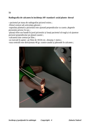 51
Radiografia de calcaneu în incidența AP/ standard -axial planto- dorsal
- pacientul pe masa de radiografiat piciorul extins ;
-filmul centrat sub articulația gleznei ;
-suprafata plantară a piciorului este ajustată perpendicular cu caseta ,degetele
piciorului privesc în sus ;
-plasați tifon sau bandă în jurul piciorului și lasați pacientul să tragă și să ajusteze
piciorul perpendicular pe planul casetei ;
-calcaneul este centrat pe film ;
-se execută în apnee ; pe flme de 18/24 cm ; distanța 1 metru ;
-raza centrală este direcționata 40 gr. cranio-caudal și pătrunde în calcaneu ;
Incidențe și poziționări în radiologie Copyright © Zaharia Tudorel
 