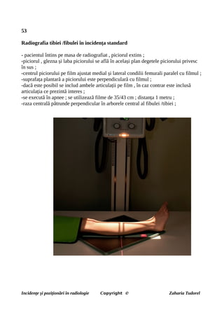 53
Radiografia tibiei /fibulei în incidența standard
- pacientul întins pe masa de radiografiat , piciorul extins ;
-piciorul , glezna și laba piciorului se află în același plan degetele piciorului privesc
în sus ;
-centrul piciorului pe film ajustat medial și lateral condilii femurali paralel cu filmul ;
-suprafața plantară a piciorului este perpendiculară cu filmul ;
-dacă este posibil se includ ambele articulații pe film , în caz contrar este inclusă
articulația ce prezintă interes ;
-se execută în apnee ; se utilizează filme de 35/43 cm ; distanța 1 metru ;
-raza centrală pătrunde perpendicular în arborele central al fibulei /tibiei ;
Incidențe și poziționări în radiologie Copyright © Zaharia Tudorel
 