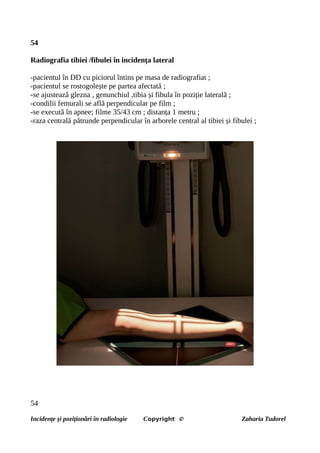 54
Radiografia tibiei /fibulei în incidența lateral
-pacientul în DD cu piciorul întins pe masa de radiografiat ;
-pacientul se rostogolește pe partea afectată ;
-se ajustează glezna , genunchiul ,tibia și fibula în poziție laterală ;
-condilii femurali se află perpendicular pe film ;
-se execută în apnee; filme 35/43 cm ; distanța 1 metru ;
-raza centrală pătrunde perpendicular în arborele central al tibiei și fibulei ;
54
Incidențe și poziționări în radiologie Copyright © Zaharia Tudorel
 
