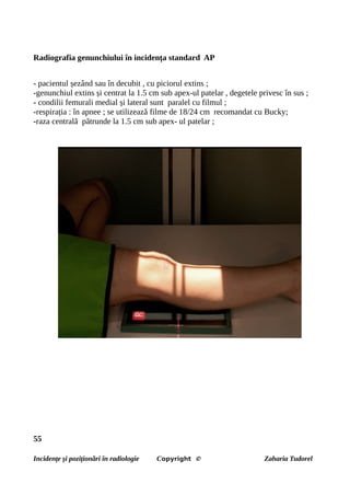 Radiografia genunchiului în incidența standard AP
- pacientul șezând sau în decubit , cu piciorul extins ;
-genunchiul extins și centrat la 1.5 cm sub apex-ul patelar , degetele privesc în sus ;
- condilii femurali medial și lateral sunt paralel cu filmul ;
-respirația : în apnee ; se utilizează filme de 18/24 cm recomandat cu Bucky;
-raza centrală pătrunde la 1.5 cm sub apex- ul patelar ;
55
Incidențe și poziționări în radiologie Copyright © Zaharia Tudorel
 