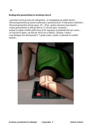 57
Radiografia genunchiului în incidența lateral
- pacientul culcat pe masa de radiografiat , se rostogolește pe șoldul afectat ;
-flexează genunchiul pe partea neafectată și așează piciorul în față pentru stabilitate ;
-flexează genunchiul afectat aprox. 20 – 30 gr . pentru relaxarea musculaturii ;
-centru genunchiului se află pe film la 1.5 cm sub apex- ul patelar ;
-palpați și reglați condilii astfel încat să fie suprapuși și perpendiculari pe caseta ;
-se execută în apnee ; pe film de 18/24 cm cu Bucky ; distanța 1 metru ;
-raza Rontgen este direcționată 5- 7 grade cranio -caudal și părunde în condilii
mediali ;
Incidențe și poziționări în radiologie Copyright © Zaharia Tudorel
 