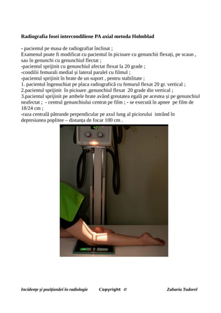 Radiografia fosei intercondiliene PA axial metoda Holmblad
- pacientul pe masa de radiografiat înclinat ;
Examenul poate fi modificat cu pacientul în picioare cu genunchii flexați, pe scaun ,
sau în genunchi cu genunchiul flectat ;
-pacientul sprijinit cu genunchiul afectat flexat la 20 grade ;
-condilii femurali medial și lateral paralel cu filmul ;
-pacientul sprijinit în brate de un suport , pentru stabilitate ;
1. pacientul îngenuchiat pe placa radiografică cu femurul flexat 20 gr. vertical ;
2.pacientul sprijinit în picioare ,genunchiul flexat 20 grade din vertical ;
3.pacientul sprijinit pe ambele brate având greutatea egală pe acestea și pe genunchiul
neafectat ; - centrul genunchiului centrat pe film ; - se execută în apnee pe film de
18/24 cm ;
-raza centrală pătrunde perpendicular pe axul lung al piciorului intrând în
depresiunea poplitee – distanța de focar 100 cm .
Incidențe și poziționări în radiologie Copyright © Zaharia Tudorel
 