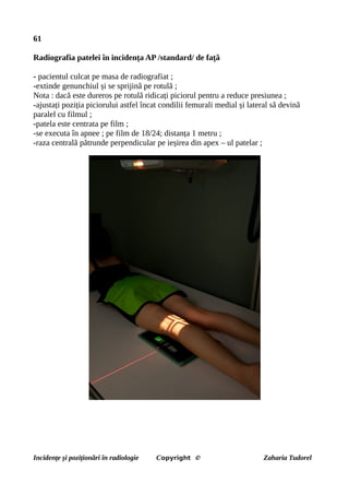 61
Radiografia patelei în incidența AP /standard/ de față
- pacientul culcat pe masa de radiografiat ;
-extinde genunchiul și se sprijină pe rotulă ;
Nota : dacă este dureros pe rotulă ridicați piciorul pentru a reduce presiunea ;
-ajustați poziția piciorului astfel încat condilii femurali medial și lateral să devină
paralel cu filmul ;
-patela este centrata pe film ;
-se executa în apnee ; pe film de 18/24; distanța 1 metru ;
-raza centrală pătrunde perpendicular pe ieșirea din apex – ul patelar ;
Incidențe și poziționări în radiologie Copyright © Zaharia Tudorel
 