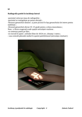 62
Radiografia patelei în incidența lateral
-pacientul culcat pe masa de radiografiat ;
-pacientul se rostogolește pe partea afectată ;
-flexeaza genunchiul sănators și pune piciorul în fața genunchiului de interes pentru
stabilitate ;
-flexează genunchiul afectat 10 -15 grade pentru a relaxa musculatura ;
Nota : o flexie exagerată scade spațiul articulației rotuliene .
-se centreaza patela pe film ;
-se execută în apnee ; utilizăm filme de 18/24 cm ; distanța 1 metru ;
- raza centrală pătrunde medial în spatiul patelofemural (atriculația rotuliană )
Incidențe și poziționări în radiologie Copyright © Zaharia Tudorel
 