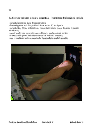 63
Radiografia patelei în incidența tangențială – cu utilizare de dispozitive speciale
-pacientul așezat pe masa de radiografiat ;
-flexează genunchiul din pozitia extinsa aprox. 30 - 45 grade ;
-pacientul ține filmul apăsând ușor cu acesta în țesutul moale din zona femurală
anterioară ;
-planul patelei este perpendicular cu filmul ; patela centrată pe film ;
-se execută în apnee; pe filme de 18/24 cm ;distanța 1 metru ;
-raza centrală pătrunde perpendicular în articulația patelofemurală ;
Incidențe și poziționări în radiologie Copyright © Zaharia Tudorel
 