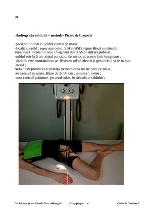 68
Radiografia șoldului – metoda- Picior de broască
-pacientul culcat cu șoldul centrat pe masă ;
-localizare șold : reper anatomic : SIAS (ASIS) spina iliacă anterioară
superioară ,formăm o linie imaginară din SIAS și simfiza pubiană ;
-șoldul este la 5 cm distal punctului de mijloc al acestei linii imaginare ;
-dacă nu este contraindicat se flexeaza șoldul afectat și genunchiul și se rotește
lateral ;
Notă : este posibil ca suprafața picioarelor să nu fie plata pe masa .
-se execută în apnee; filme de 24/30 cm ; distanța 1 metru ;
-raza centrală pătrunde perpendicular în atriculația șoldului ;
Incidențe și poziționări în radiologie Copyright © Zaharia Tudorel
 