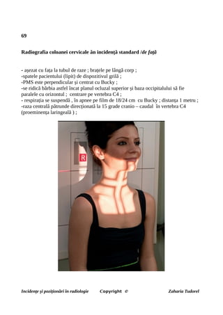 69
Radiografia coloanei cervicale ân incidență standard /de față
- așezat cu fața la tubul de raze ; brațele pe lângă corp ;
-spatele pacientului (lipit) de dispozitivul grilă ;
-PMS este perpendicular și centrat cu Bucky ;
-se ridică bărbia astfel încat planul ocluzal superior și baza occipitalului să fie
paralele cu orizontul ; centrare pe vertebra C4 ;
- respirația se suspendă , în apnee pe film de 18/24 cm cu Bucky ; distanța 1 metru ;
-raza centrală pătrunde direcționată la 15 grade cranio – caudal în vertebra C4
(proeminența laringeală ) ;
Incidențe și poziționări în radiologie Copyright © Zaharia Tudorel
 