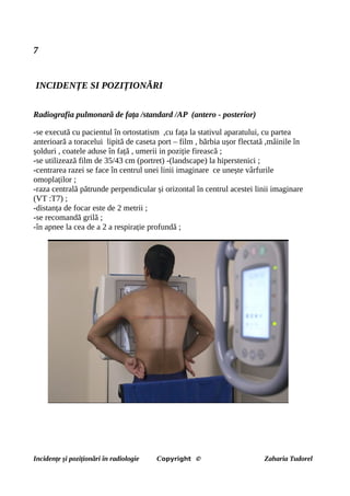 7
INCIDENȚE SI POZIȚIONĂRI
Radiografia pulmonară de fața /standard /AP (antero - posterior)
-se execută cu pacientul în ortostatism ,cu fața la stativul aparatului, cu partea
anterioară a toracelui lipită de caseta port – film , bărbia ușor flectată ,mâinile în
șolduri , coatele aduse în față , umerii in poziție firească ;
-se utilizează film de 35/43 cm (portret) -(landscape) la hiperstenici ;
-centrarea razei se face în centrul unei linii imaginare ce unește vârfurile
omoplaților ;
-raza centrală pătrunde perpendicular și orizontal în centrul acestei linii imaginare
(VT :T7) ;
-distanța de focar este de 2 metrii ;
-se recomandă grilă ;
-în apnee la cea de a 2 a respirație profundă ;
Incidențe și poziționări în radiologie Copyright © Zaharia Tudorel
 