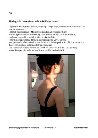 70
Radiografia coloanei cervicale în incidența lateral
-așezat cu fața la tubul de raze, brațele pe lângă corp ,în ortostatism în decubit sau
așezat pe scaun ;
-planul mediocoronal PMC este perpendicular centrat pe film ;
-umărul pe dispozitivul cu Bucky ; bărbia ușor extinsă cu umerii relaxați ;
-coloana cervicală centrată pe film la nivelul C4 ;
-marginea superioară a filmului este aproape de vârful urechii ;
-se ajustează curbura cervicală astfel încât o linie superioară a plăcii ocluzale și a
bazei occipitalului să fie paralele cu podeaua ;
-se execută în apnee ; pe film de 18/24 cm ; distanța 2 metrii ; cu Bucky ;
-raza Rontgen pătrunde perpendicular pe film la nivelul C4 ;
Incidențe și poziționări în radiologie Copyright © Zaharia Tudorel
 