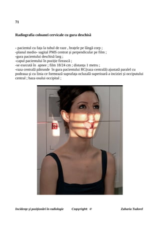 71
Radiografia coloanei cervicale cu gura deschisă
- pacientul cu fața la tubul de raze , brațele pe lângă corp ;
-planul medio- sagital PMS centrat și perpendicular pe film ;
-gura pacientului deschisă larg ;
-capul pacientului în poziție firească ;
-se execută în apnee ; film 18/24 cm ; distanța 1 metru ;
-raza centrală pătrunde în gura pacientului RC(raza centrală) ajustată paralel cu
podeaua și cu linia ce formează suprafața ocluzală superioară a inciziei și occiputului
central ; baza osului occipital ;
Incidențe și poziționări în radiologie Copyright © Zaharia Tudorel
 