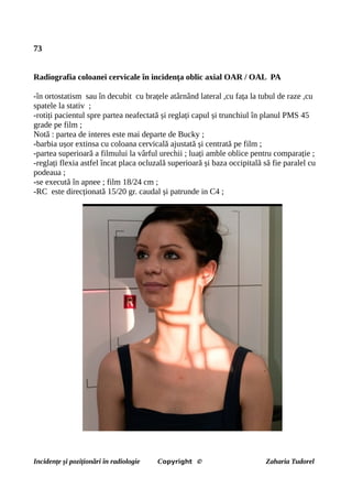 73
Radiografia coloanei cervicale în incidența oblic axial OAR / OAL PA
-în ortostatism sau în decubit cu brațele atârnând lateral ,cu fața la tubul de raze ,cu
spatele la stativ ;
-rotiți pacientul spre partea neafectată și reglați capul și trunchiul în planul PMS 45
grade pe film ;
Notă : partea de interes este mai departe de Bucky ;
-barbia ușor extinsa cu coloana cervicală ajustată și centrată pe film ;
-partea superioară a filmului la vârful urechii ; luați amble oblice pentru comparație ;
-reglați flexia astfel încat placa ocluzală superioară și baza occipitală să fie paralel cu
podeaua ;
-se execută în apnee ; film 18/24 cm ;
-RC este direcționată 15/20 gr. caudal și patrunde in C4 ;
Incidențe și poziționări în radiologie Copyright © Zaharia Tudorel
 
