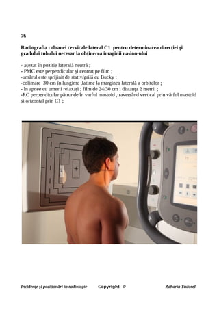 76
Radiografia coloanei cervicale lateral C1 pentru determinarea direcției și
gradului tubului necesar la obținerea imaginii nasion-ului
- așezat în pozitie laterală neutră ;
- PMC este perpendicular și centrat pe film ;
-umărul este sprijinit de stativ/grilă cu Bucky ;
-colimare 30 cm în lungime ,latime la marginea laterală a orbitelor ;
- în apnee cu umerii relaxați ; film de 24/30 cm ; distanța 2 metrii ;
-RC perpendicular pătrunde în varful mastoid ,traversând vertical prin vârful mastoid
și orizontal prin C1 ;
Incidențe și poziționări în radiologie Copyright © Zaharia Tudorel
 