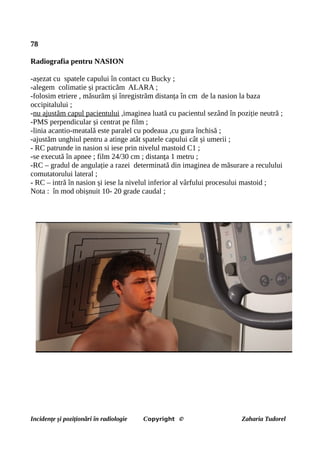 78
Radiografia pentru NASION
-așezat cu spatele capului în contact cu Bucky ;
-alegem colimatie și practicăm ALARA ;
-folosim etriere , măsurăm și înregistrăm distanța în cm de la nasion la baza
occipitalului ;
-nu ajustăm capul pacientului ,imaginea luată cu pacientul sezând în poziție neutră ;
-PMS perpendicular și centrat pe film ;
-linia acantio-meatală este paralel cu podeaua ,cu gura închisă ;
-ajustăm unghiul pentru a atinge atât spatele capului cât și umerii ;
- RC patrunde in nasion si iese prin nivelul mastoid C1 ;
-se execută în apnee ; film 24/30 cm ; distanța 1 metru ;
-RC – gradul de angulație a razei determinată din imaginea de măsurare a reculului
comutatorului lateral ;
- RC – intră în nasion și iese la nivelul inferior al vârfului procesului mastoid ;
Nota : în mod obișnuit 10- 20 grade caudal ;
Incidențe și poziționări în radiologie Copyright © Zaharia Tudorel
 