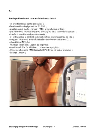 82
Radiografia coloanei toracale în incidența lateral
- în ortostatism sau așezat (pe scaun) ;
-folosim colimație și practicăm ALARA ;
-ajustăm planul medio -coronar PMC perpendicular pe film ;
-plasați curbura toracică impotriva Bucky ; RC intră în interiorul curburii ;
-brațele și umerii sunt deplasate anterior ;
-CT este ajustată și centrată reducând curbura cifotică centrată pe film ;
-marginea superioară a filmului este la 4 cm deasupra nivelului C7 ;
-plasați filtrul NOLAN ;
-respirație superficială , apnee pe inspirație ;
-se utilizează film de 35/43 cm ; colimare de apropiere ;
-RC perpendicular în PMC la nivelul C7 inferior vârfurilor scapulare ;
-distanța 1 metru ;
Incidențe și poziționări în radiologie Copyright © Zaharia Tudorel
 