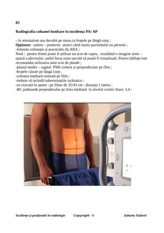 83
Radiografia coloanei lombare în incidența PA/ AP
- în ortostatism sau decubit pe masa cu brațele pe lângă corp ;
Opțiunea : antero – posterior atunci când starea pacientului nu permite ;
-folosim colimație și practicăm ALARA ;
Notă : pentru femei poate fi utilizat un scut de cupru, rezultând o imagine semi –
opacă a plevisului ,astfel încat zona sacrală să poată fi vizualizată .Pentru bărbați este
recomandat utilizarea unui scut de plumb ;
-planul medio – sagital PMS centrat și perpendicular pe film ;
-brațele căzute pe lângă corp ;
-coloana lombară centrată pe film ;
-trebuie să includă tuberozitațiile ischiatice ;
-se execută în apnee ; pe filme de 35/43 cm ; distanța 1 metru ;
-RC paătrunde perpendicular pe linia mediană la nivelul crestei iliace L4 ;
Incidențe și poziționări în radiologie Copyright © Zaharia Tudorel
 