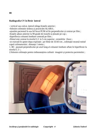 88
Radiografia CV în flexie lateral
- vertical sau culcat ,lateral stânga brațele anterior ;
-folosim colimatie strânsa și practicăm ALARA ;
-ajustăm pacientul în asa fel încat PCM să fie perpendicular și centrat pe film ;
-brațele aduse anterior la 90 grade de trunchi și plasate pe cap ;
-hiperflexia coloanei lombare centrată pe film ;
-filmul este centrat la nivelul L3 la 5 cm superior crestelelor iliace ;
-se execută în apnee dupa expirație ; pe filme de 35/43 cm , colimație stransă rotind
capul colimatorului ; distanța 1 metru ;
1. RC ajustată perpendicular pe axul lung al coloanei lombare aflate în hiperflexie la
nivelul L 3 ;
2.folosim colimație pentru imbunatațirea calitatii imaginii și protectia pacientului ;
Incidențe și poziționări în radiologie Copyright © Zaharia Tudorel
 