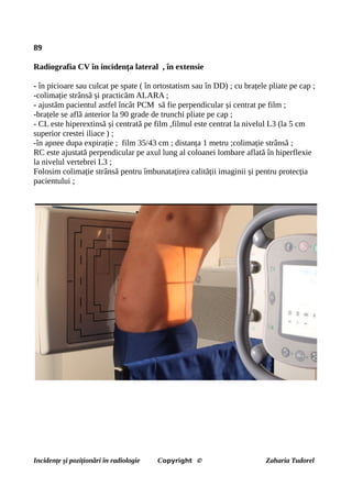 89
Radiografia CV în incidența lateral , în extensie
- în picioare sau culcat pe spate ( în ortostatism sau în DD) ; cu brațele pliate pe cap ;
-colimație strânsă și practicăm ALARA ;
- ajustăm pacientul astfel încât PCM să fie perpendicular și centrat pe film ;
-brațele se află anterior la 90 grade de trunchi pliate pe cap ;
- CL este hiperextinsă și centrată pe film ,filmul este centrat la nivelul L3 (la 5 cm
superior crestei iliace ) ;
-în apnee dupa expirație ; film 35/43 cm ; distanța 1 metru ;colimație strânsă ;
RC este ajustată perpendicular pe axul lung al coloanei lombare aflată în hiperflexie
la nivelul vertebrei L3 ;
Folosim colimație strânsă pentru îmbunatațirea calității imaginii și pentru protecția
pacientului ;
Incidențe și poziționări în radiologie Copyright © Zaharia Tudorel
 