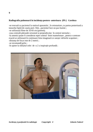9
Radiografia pulmonară în incidența postero -anterioara (PA ) -Lordoza
-se execută cu pacientul la stativul aparatului , în ortostatism ,cu partea posterioară a
toracelui lipită de caseta port- film , pacientul face un pas înainte ;
-se utilizează filme de 35/43 cm (portret);
-raza centrală pătrunde orizontal și perpendicular în centrul sternului ;
-la astenici poate fi considerat reper centrul liniei mamelonare , pentru o centrare
exactă se utilizează în continuare linia imaginară ce unește vârfurile scapulare ;
-distanța de focar este de 2 metrii ;
-se recomandă grila ;
-în apnee la sfârșitul celei de -a 2 a inspirație profundă ;
Incidențe și poziționări în radiologie Copyright © Zaharia Tudorel
 