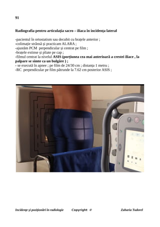 91
Radiografia pentru articulația sacro – iliaca în incidența lateral
-pacientul în ortostatism sau decubit cu brațele anterior ;
-colimație strânsă și practicam ALARA ;
-ajustăm PCM perpendicular și centrat pe film ;
-brațele extinse și pliate pe cap ;
-filmul centrat la nivelul ASIS (porțiunea cea mai anterioară a crestei iliace , la
palpare se simte ca un bulgăre ) ;
- se execută în apnee ; pe film de 24/30 cm ; distanța 1 metru ;
-RC perpendicular pe film pătrunde la 7.62 cm posterior ASIS ;
Incidențe și poziționări în radiologie Copyright © Zaharia Tudorel
 
