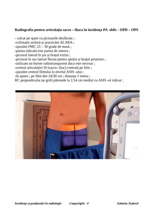 Radiografia pentru articulația sacro – iliaca în incidența PA oblic - OPD – OPS
- culcat pe spate cu picioarele desfăcute ;
-colimație strânsă și practicăm ALARA ;
-ajustăm PMC 25 – 30 grade de masă ;
-partea ridicată este partea de interes ;
-piciorul lateral în jos și brațul extins ;
-piciorul în sus lateral flectat pentru sprijin și brațul posterior ;
-utilizam un burete radiotransparent daca este necesar ;
-centrul articulației SI (sacro- iliac) centrată pe film ;
-ajustăm centrul filmului la nivelul ASIS -ului ;
-în apnee ; pe film dee 24/30 cm ; distanța 1 metru ;
RC perpendicular pe grilă pătrunde la 2.54 cm medial cu ASIS -ul ridicat ;
Incidențe și poziționări în radiologie Copyright © Zaharia Tudorel
 