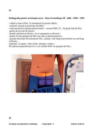 97
Radiografia pentru articulația sacro – iliaca în incidența AP oblic - OPD – OPS
- stând cu fața la film ; în ortostatism în poziție oblică ;
-colimare stransă și practicăm ALARA ;
-rotiți pacientul și ajustați planul medio – coronal PMC 25 – 30 grade fată de film;
-partea de jos este de interes;
-brațele sprijinite pe Bucky ; nu se suprapune cu plevisul ;
-brațul cel mai apropiat de film este adus și plasat posterior ;
-ajustați articulația SI centrată pe film , ajustați axul lung al pacientului cu axul lung
al Bucky ;
respirație : în apnee ; film 24/30 ; distanța 1 metru ;
RC pătrune perpendicular la 2.5 cm medial ASIS -ul apropiat de film ;
97
Incidențe și poziționări în radiologie Copyright © Zaharia Tudorel
 