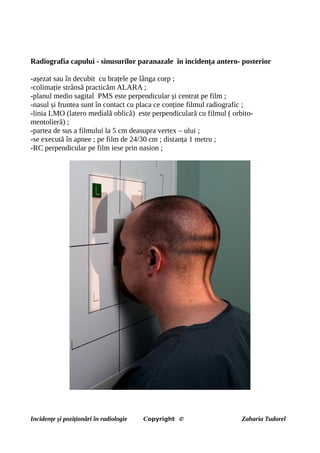 Radiografia capului - sinusurilor paranazale în incidența antero- posterior
-așezat sau în decubit cu brațele pe lânga corp ;
-colimație strânsă practicăm ALARA ;
-planul medio sagital PMS este perpendicular și centrat pe film ;
-nasul și fruntea sunt în contact cu placa ce conține filmul radiografic ;
-linia LMO (latero medială oblică) este perpendiculară cu filmul ( orbito-
mentolieră) ;
-partea de sus a filmului la 5 cm deasupra vertex – ului ;
-se execută în apnee ; pe film de 24/30 cm ; distanța 1 metru ;
-RC perpendicular pe film iese prin nasion ;
Incidențe și poziționări în radiologie Copyright © Zaharia Tudorel
 