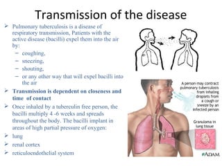 Transmission of the disease
 Pulmonary tuberculosis is a disease of
respiratory transmission, Patients with the
active disease (bacilli) expel them into the air
by:
– coughing,
– sneezing,
– shouting,
– or any other way that will expel bacilli into
the air
 Transmission is dependent on closeness and
time of contact
 Once inhaled by a tuberculin free person, the
bacilli multiply 4 -6 weeks and spreads
throughout the body. The bacilli implant in
areas of high partial pressure of oxygen:
 lung
 renal cortex
 reticuloendothelial system
 