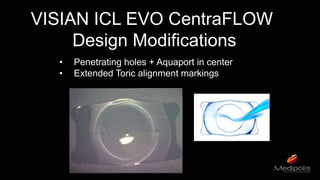 VISIAN ICL EVO CentraFLOW
Design Modifications
• Penetrating holes + Aquaport in center
• Extended Toric alignment markings
 